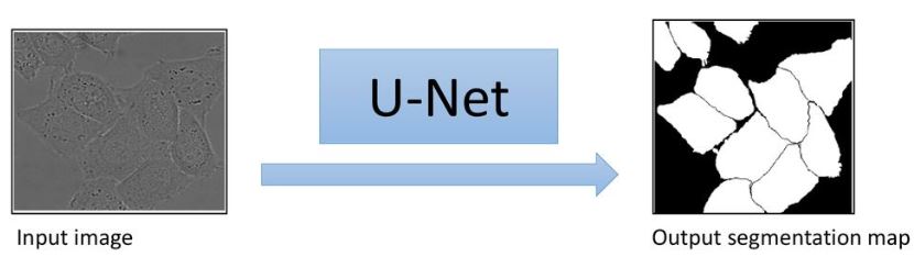 fig 2: U-Net